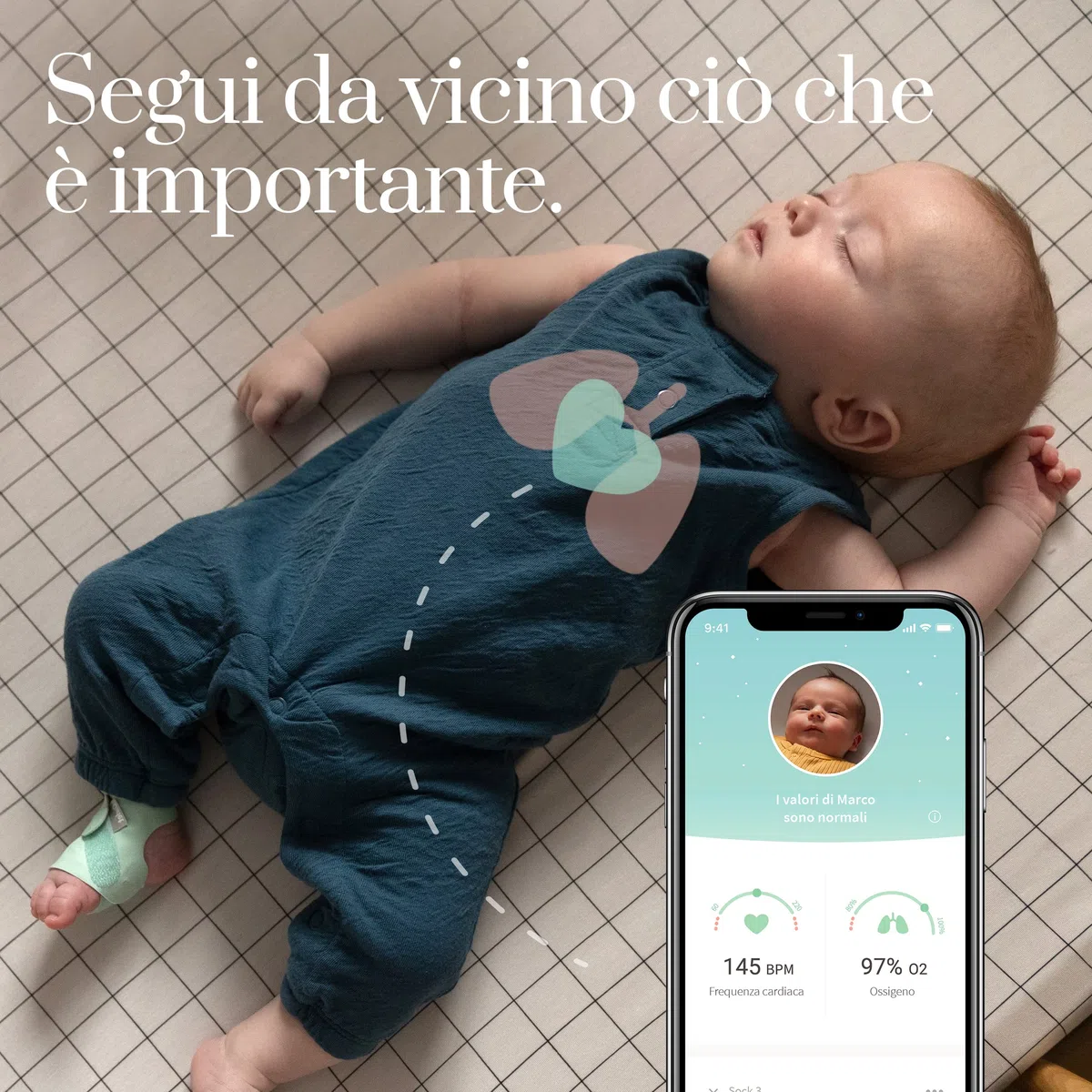 Baby monitor Smart Sock 3 di Owlet con misurazione dei valori di ossigeno e frequenza cardiaca